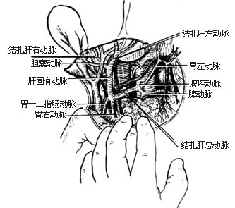 肝动脉结扎术