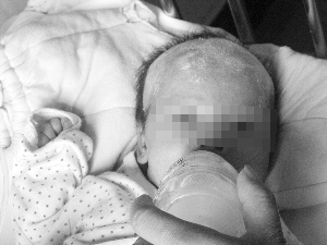 患性病孕妇产下健康女婴 医生称其有精神疾病