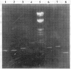 自身抗原SSB/La抗原优势表位分析