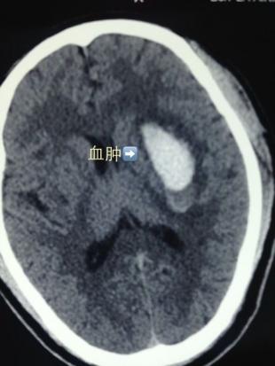周岩：我拉回踏入了鬼门关的民工
