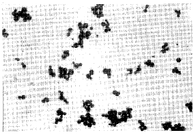 利用磁性细胞分选技术阴性选择法分离外周血嗜酸性粒细胞