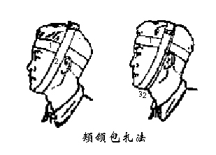 不同部位的绷带包扎步骤