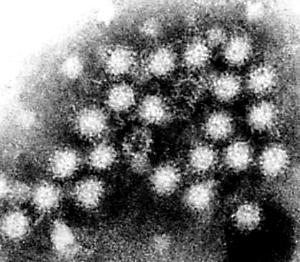 防诺如病毒腹泻：牡蛎贝类煮熟 饭前便后洗手