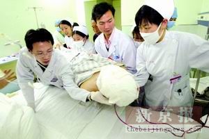 狮面人18小时手术回顾：主刀教授累到抽筋