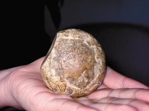 军医提醒：警惕“疯狂的石头”侵占你的胃