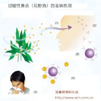 过敏性鼻炎的发病机理