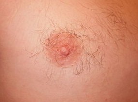 男性乳头