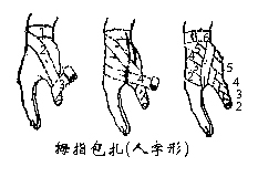 拇指包扎