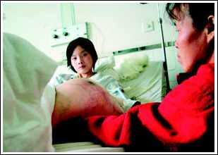 15岁少女骨瘦如柴 腿上肿瘤30斤重大如脸盆
