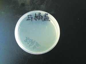 记者调查9个卫生死角：牙刷洗碗布棉拖鞋最脏