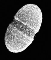 国际人类微生物组计划一期项目将结束 前途未卜