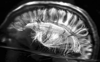 科学家首次发现人脑神经纤维排列方式