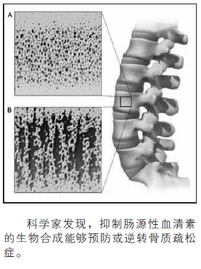 抑制血清素生物合成可有效治疗骨质疏松