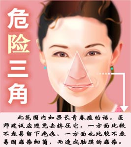 治痘坑痘印要内外兼修