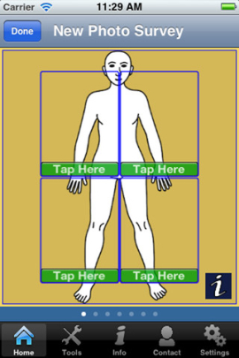 免费的iOS应用程序 可自行诊断皮肤癌