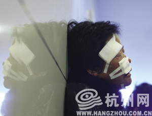 女子脸部被恶狗咬三口 称差点连头都被啃掉