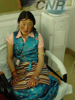 怪病！四川一藏女两年只能吃果子