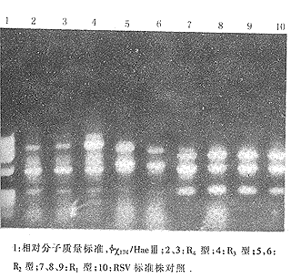 婴幼儿呼吸道合胞病毒感染分子流行病学研究