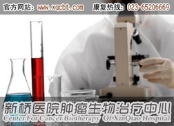 肺癌治疗应强调分期治疗和综合治疗