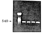 CD45 MOLECULE AND GENERATION OF EPIDERMAL γδ T CELLS FROM MIC