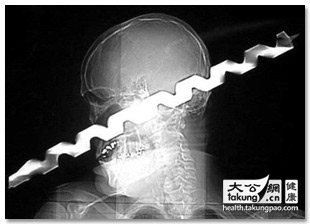 盘点真实世界中的“不死之身”