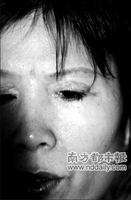 女子让亲戚做双眼皮 3年无法闭眼