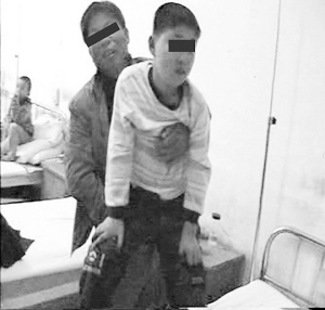 多元化阶梯式疗法治疗肌营养不良症