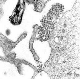 Sci Transl Med：杀死登革病毒的人源抗体