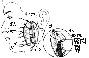腮腺切除术