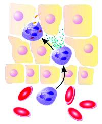 美科学家发现慢性炎症或可致癌机制