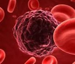 Blood：II型糖尿病患者或更易患血癌