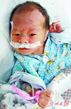 父亲因无钱医治无肛门男婴将其送人
