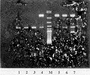 HLA-B27基因检定技术