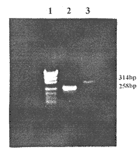 跨膜型CD59分子的构建及其在小鼠NIH3T3和EL-4细胞表达的研究