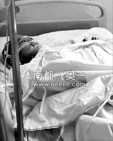 母亲火海救女被烧死 女儿60%皮肤深三度烧伤