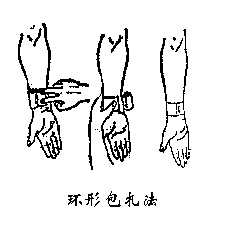 不同部位的绷带包扎步骤