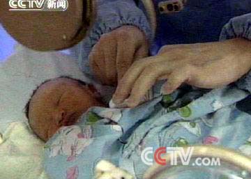 奶粉喂养重度营养不良湖南又现“大头娃娃“