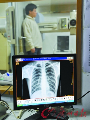 早癌筛查别陷三大误区 健康体检不能代替早癌筛查