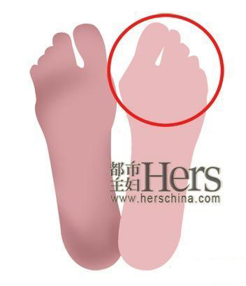 第四大问题：脚趾成了变形金刚