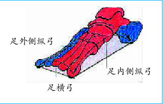 平足不等于平足症