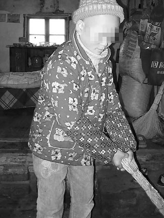 16岁女孩得怪病头发眉毛全掉光