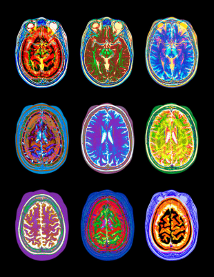 军医讲解雷射探针检测肿瘤