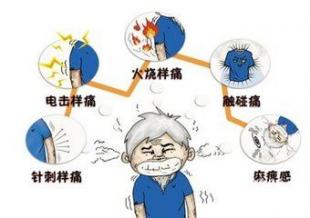 军医讲解：带状疱疹后遗神经痛