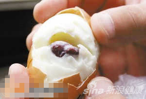 7.鸡蛋里吃出不明异物疑是蛔虫进入输卵管