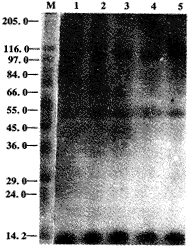 脂多糖增强小鼠腹腔巨噬细胞14.2 kD蛋白质磷酸化①