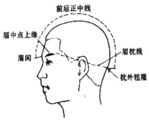 治疗中风可选头针