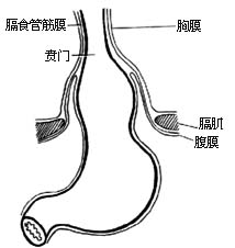 食管裂孔疝修补术