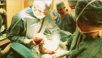 剖腹产宝宝出生瞬间