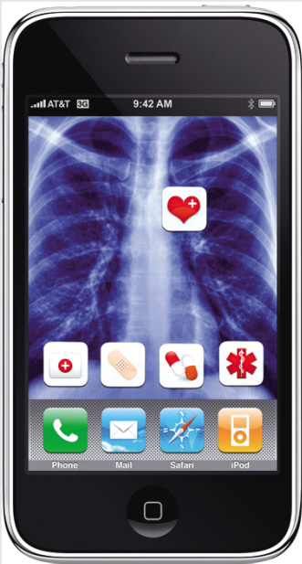 iPhone 4S诊断成像