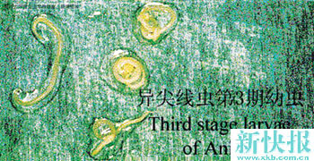 浙江宁波四成海鱼检出线虫 虫入体会致休克